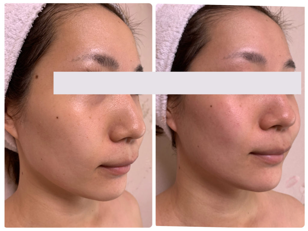 オーガニックプレミアムパウダーの効果がスゴい件！